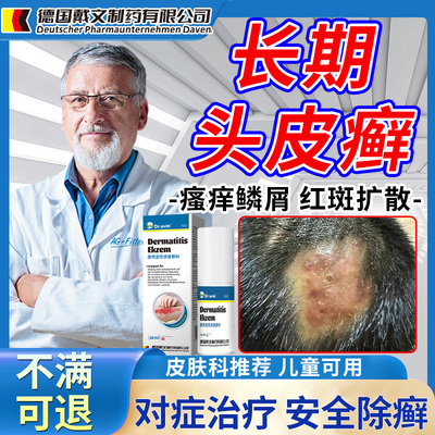 【皮肤科推荐】头皮癣止痒抑菌