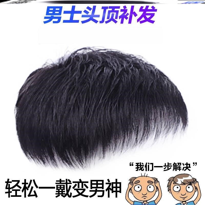极速男士头顶补发片直发补发块地中海E秃顶遮白发寸头短发BB夹自