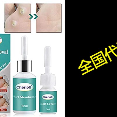 极速Wart Remover, Plantar Wart RemovaJl, Corn Callus Remove