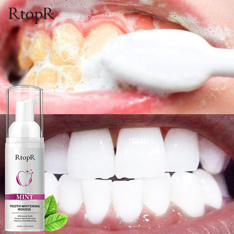 极速Teeth Cleansing Whitening Mousse ReJmoves Stains Teeth W
