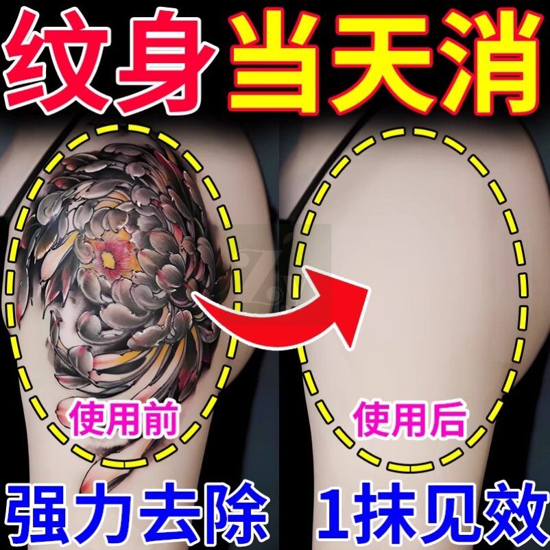洗纹身神器不留疤痕快速纹身刺青文身褪色剂去除非药水膏无痛通用