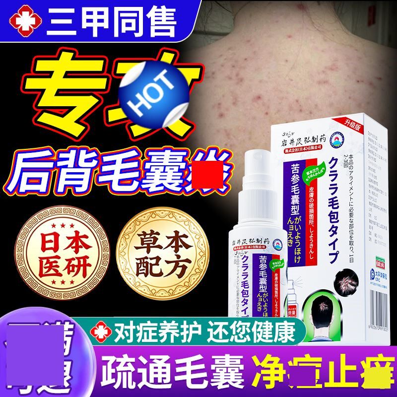 后背毛囊焱前胸后背粒消长痘痘除螨祛痘痒手臂胳膊长疙瘩膏