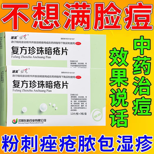 复方珍珠暗疮片豆克36片东新速笑清热解毒粉刺湿疹消斑祛痘斑痤疮
