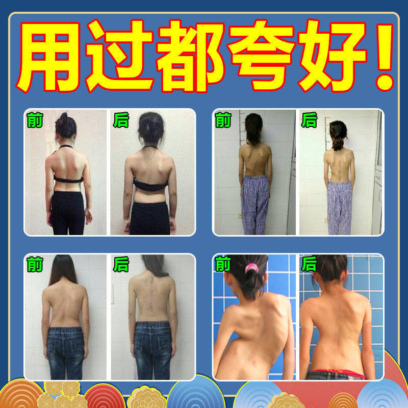 速发驼背挺背贴我又开始驼背了iouu治疗背儿童驼背矫正神器背佳女