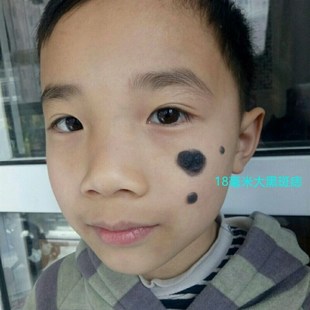 极速肉色硅胶假痣l搞笑演出表演道具媒婆痣痦子肉瘊子扮丑化妆通