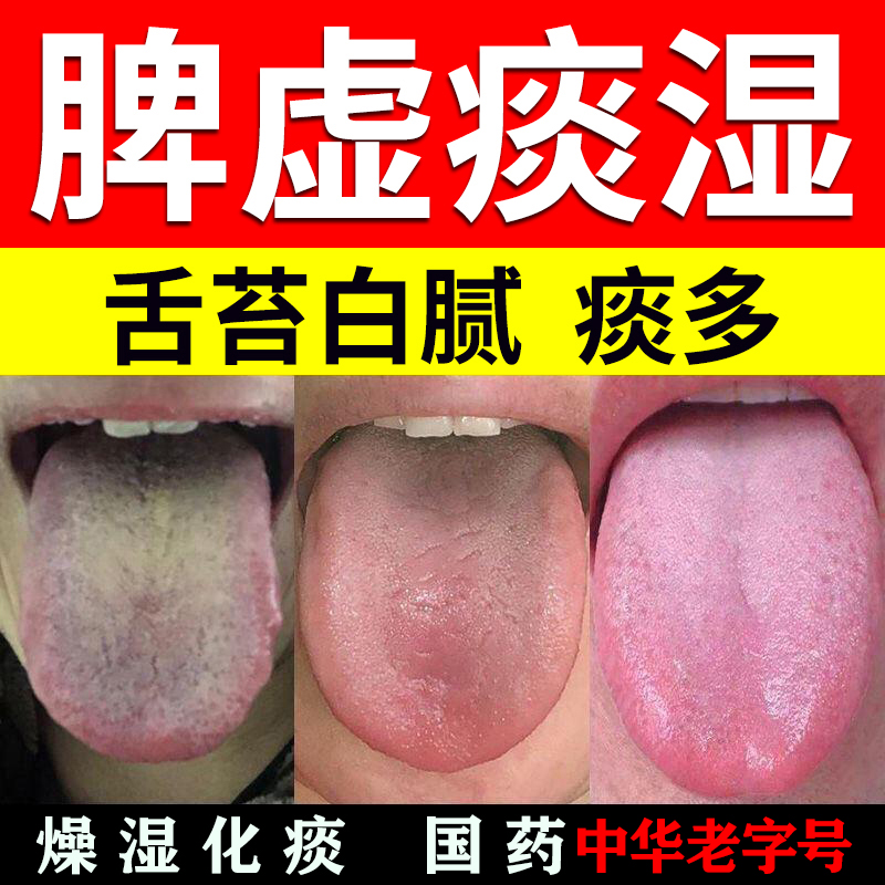 【佛慈】二陈丸(浓缩丸)0.375g*200丸/盒脾虚痰湿痰多嘴里黏腻