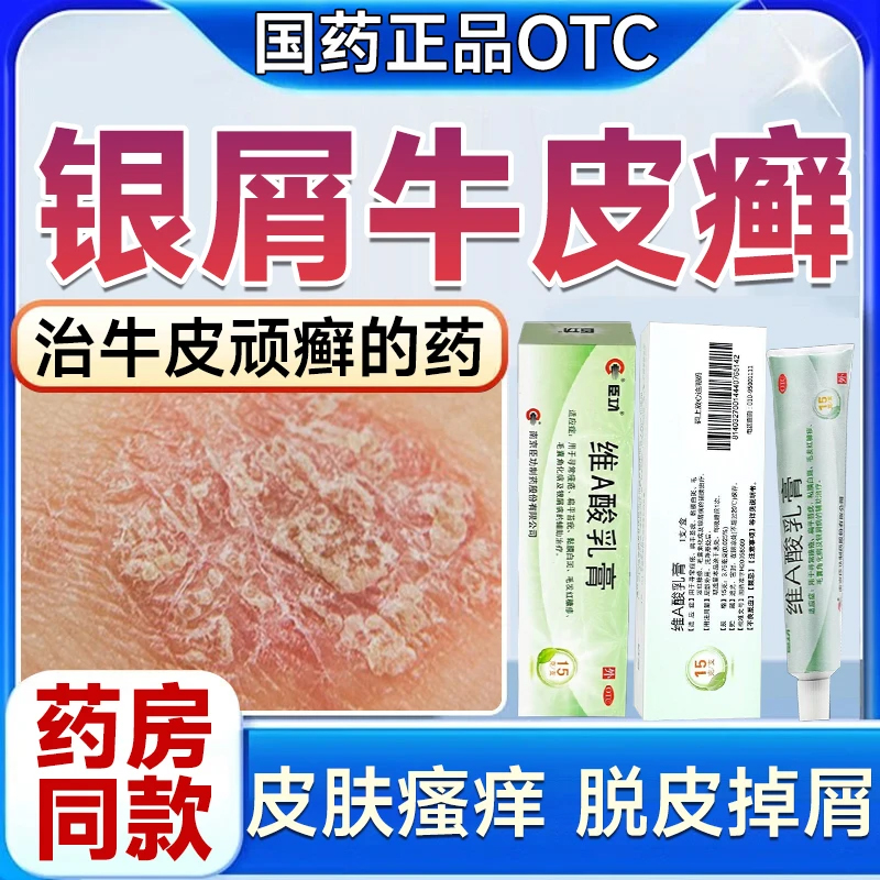 银屑病牛皮癣专用药膏官方旗舰店皮肤干燥瘙痒止痒外用维A酸乳膏