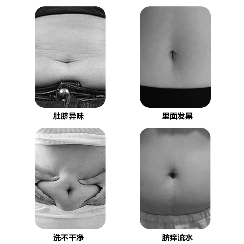 极速肚脐清洁理精华液洗肚脐眼清洁神H器软化液除臭去污垢成人儿