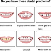 iUpper Perfect Lower 极速Silicone False Teeth Laugh Veneers