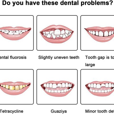 极速Silicone iUpper/Lower False Teeth Perfect Laugh Veneers