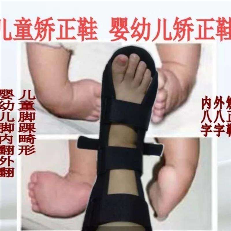 速发婴儿腿型矫正器新生儿童内八字足内翻足外翻o型腿固定矫正鞋