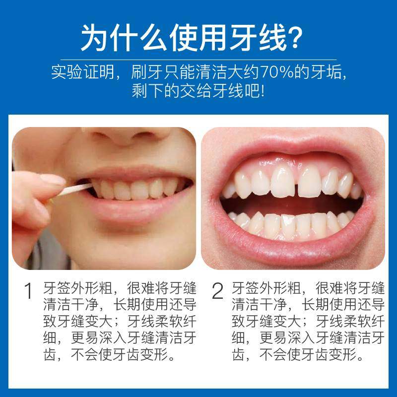 极速纳诺神蜂羽诺细滑牙线棒50支装*5盒高N拉力弓形牙线签家庭装