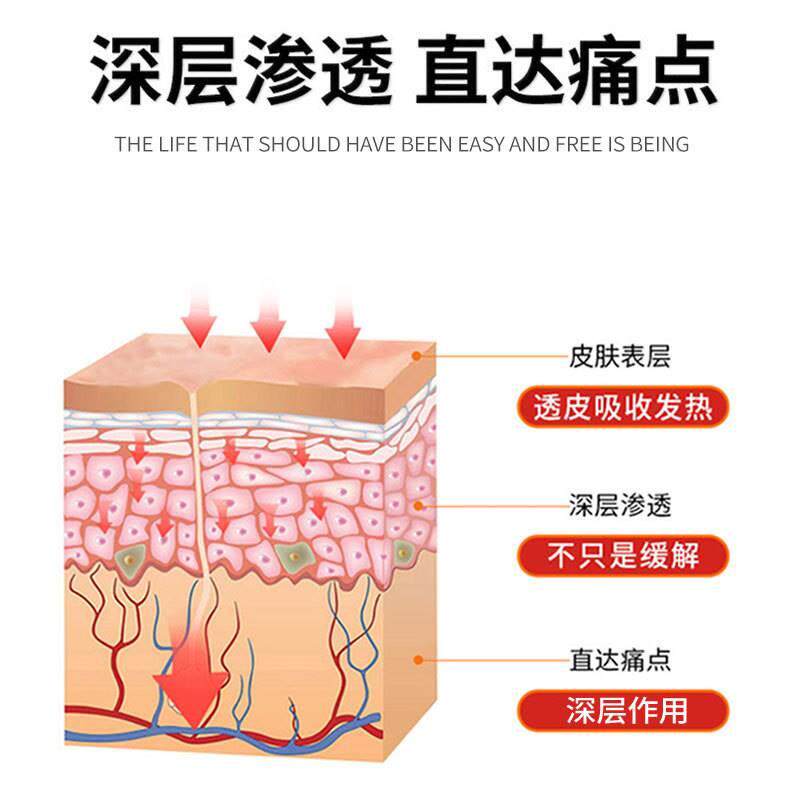 现货速发治头疼天好】膏偏神经性头疼欲裂三叉神经神器
