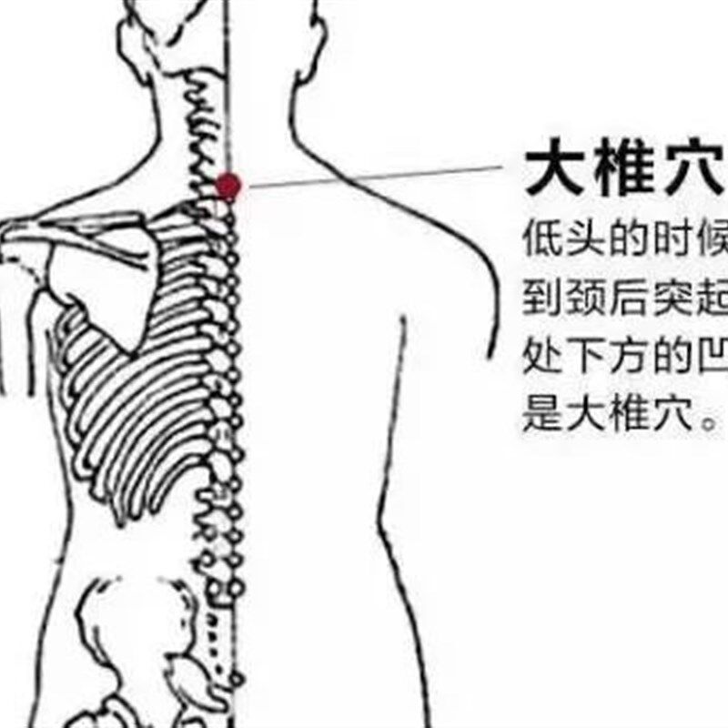 极速驼背贴矫正神器纠正背部脊柱C变形弯曲僵硬隐形贴膏坐姿脖子