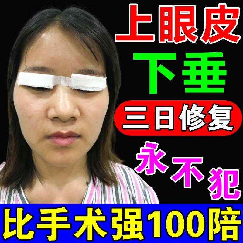 极速眼皮b下垂提拉贴上眼睑去肿定型老年人用提拉紧致双眼皮神器