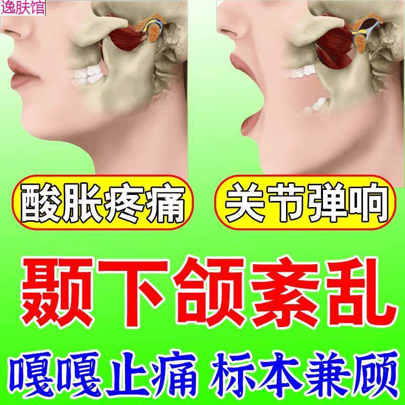 现货速发颞下颌关节紊乱热敷下巴偏颌后缩弹响张口疼痛矫正神器贴
