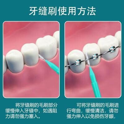 interdental brush牙缝刷便携清洁齿间刷牙缝隙刷正畸护理刷超软