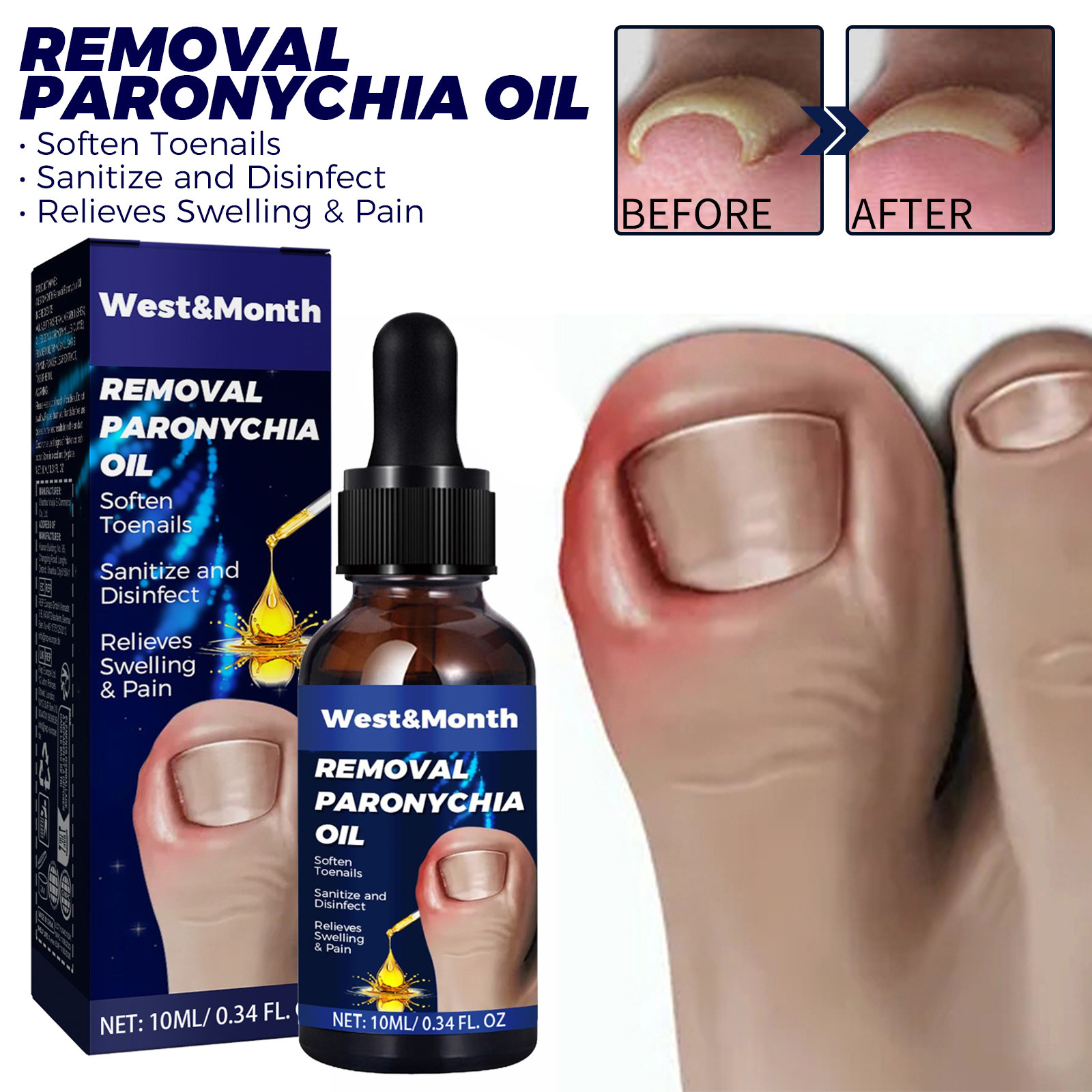 West&Month指甲护理油手足嵌甲