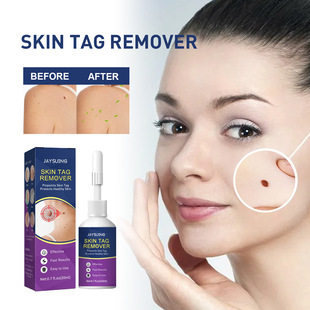 and cleans the Keyou external smoothes skin. use agent