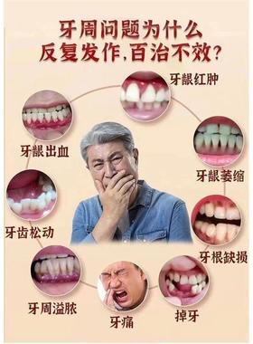 茯痛苓芦根牛片骨肽固齿牙牙齿松动松PDI软牙齿摇晃龈出血肿牙周