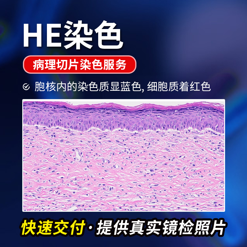 HE染色苏木精-伊红染色
