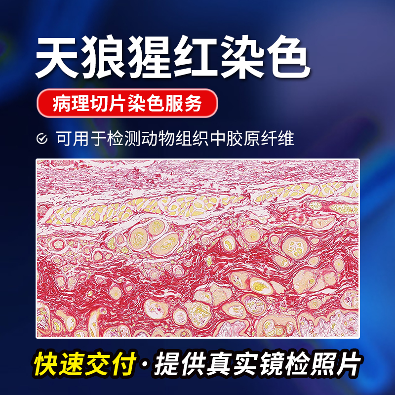 天狼猩红染色特殊染色扫描分析
