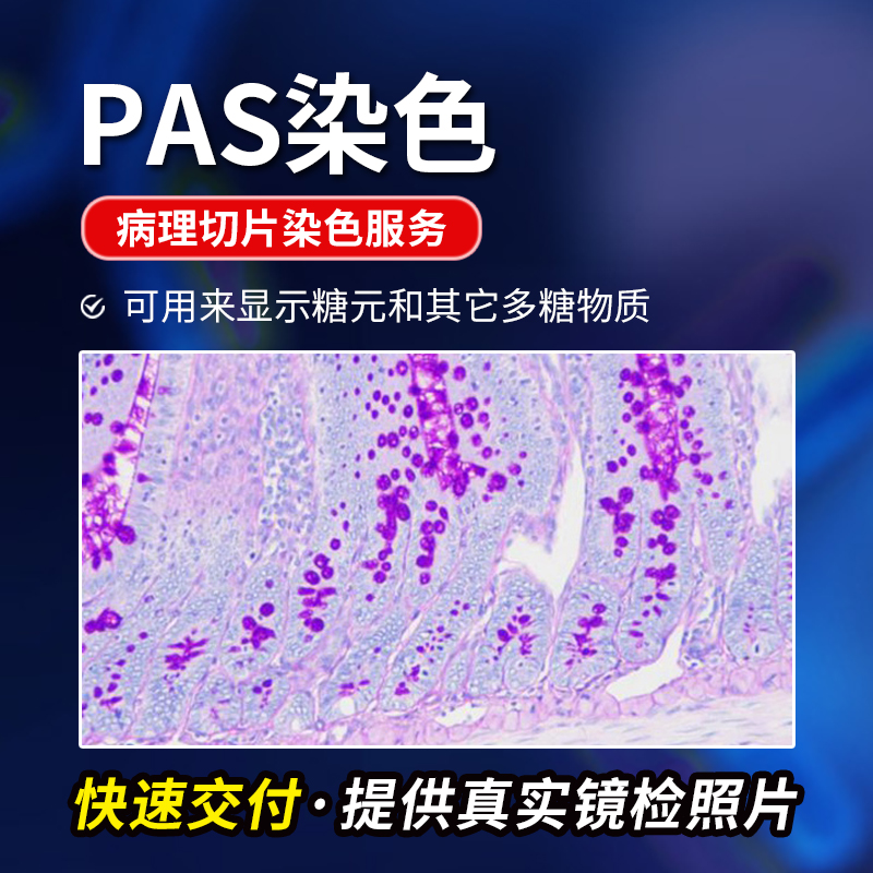 PAS染色过碘酸雪夫染色病理切片