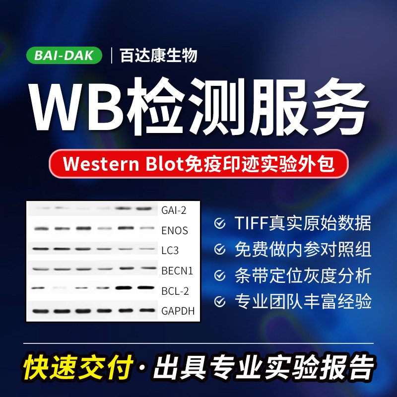 WB检测服务/Western blot免疫印迹实验外包/WB切膜孵育/整膜孵育/WB趋势代做/条带灰底分析/加内参对照 - 实物图