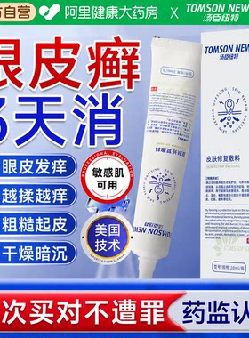 眼皮癣神经性皮炎眼皮红肿痒眼睛周围过敏发痒眼角干燥起皮掉屑膏