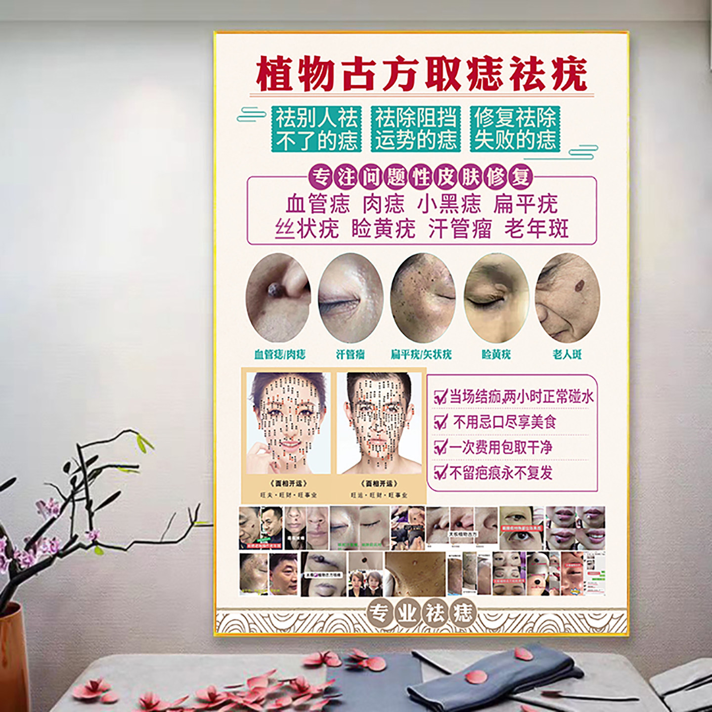 点痣美容院养生馆装饰画点痣祛疣广告海报KT板贴画海报自粘墙贴画