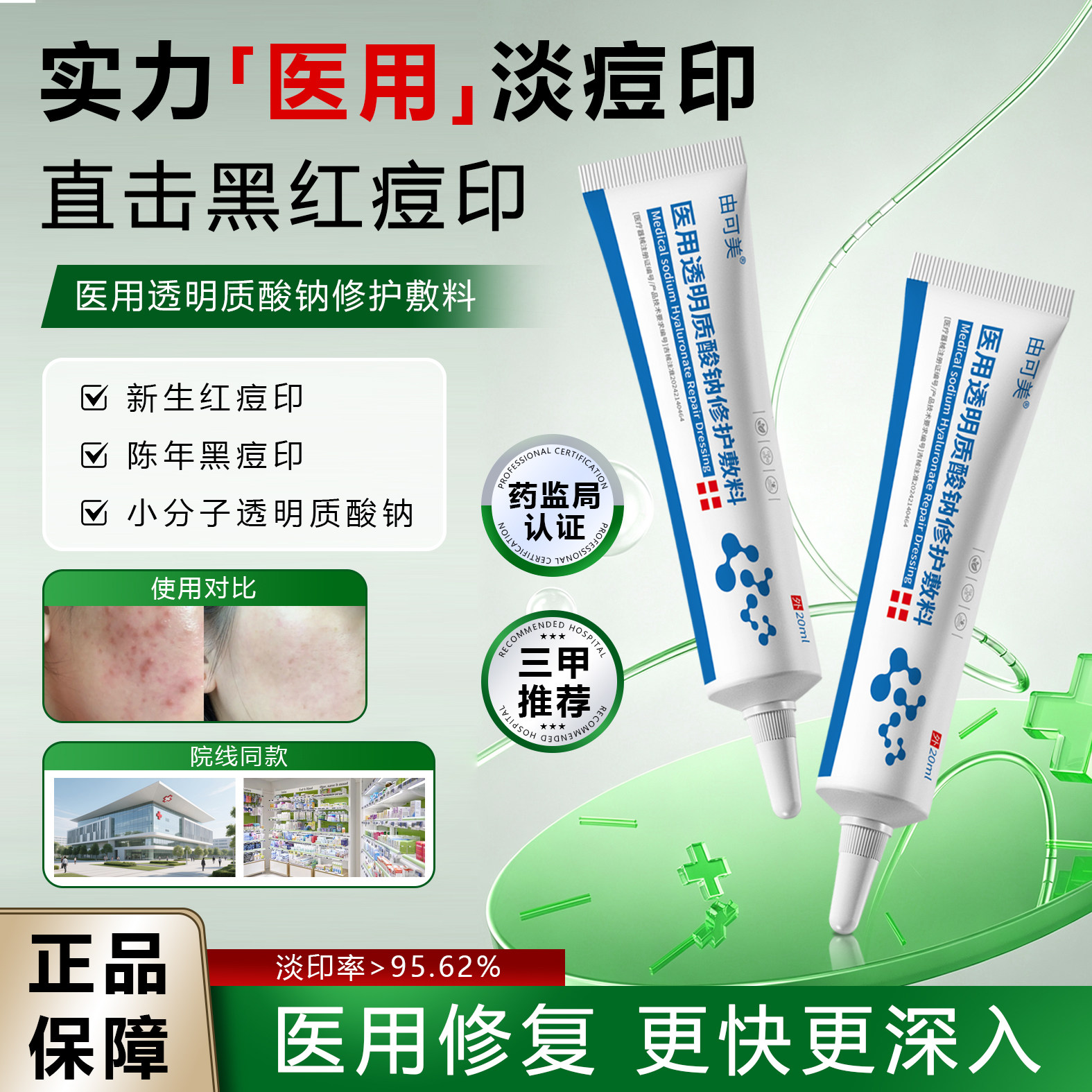 痘印闭口痘脂溢性皮炎玫瑰痤疮