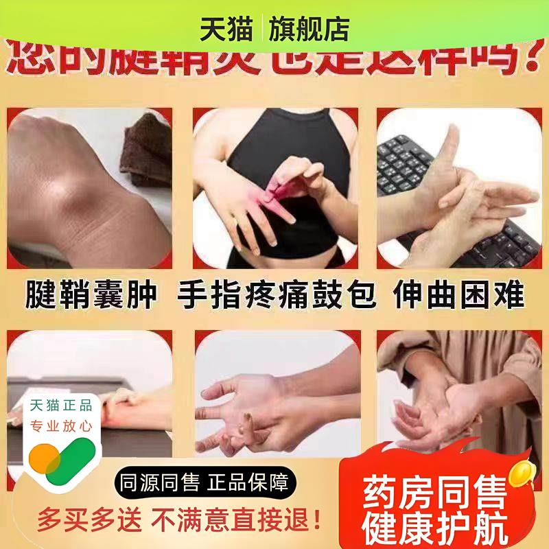 金志龙腱鞘膏dh腱鞘膏手指大拇指手腕鼓包疼痛凝胶膏