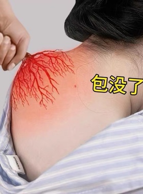 【冶好十万人】疏通肩颈神器各种颈椎问题富贵包只要富贵不要包