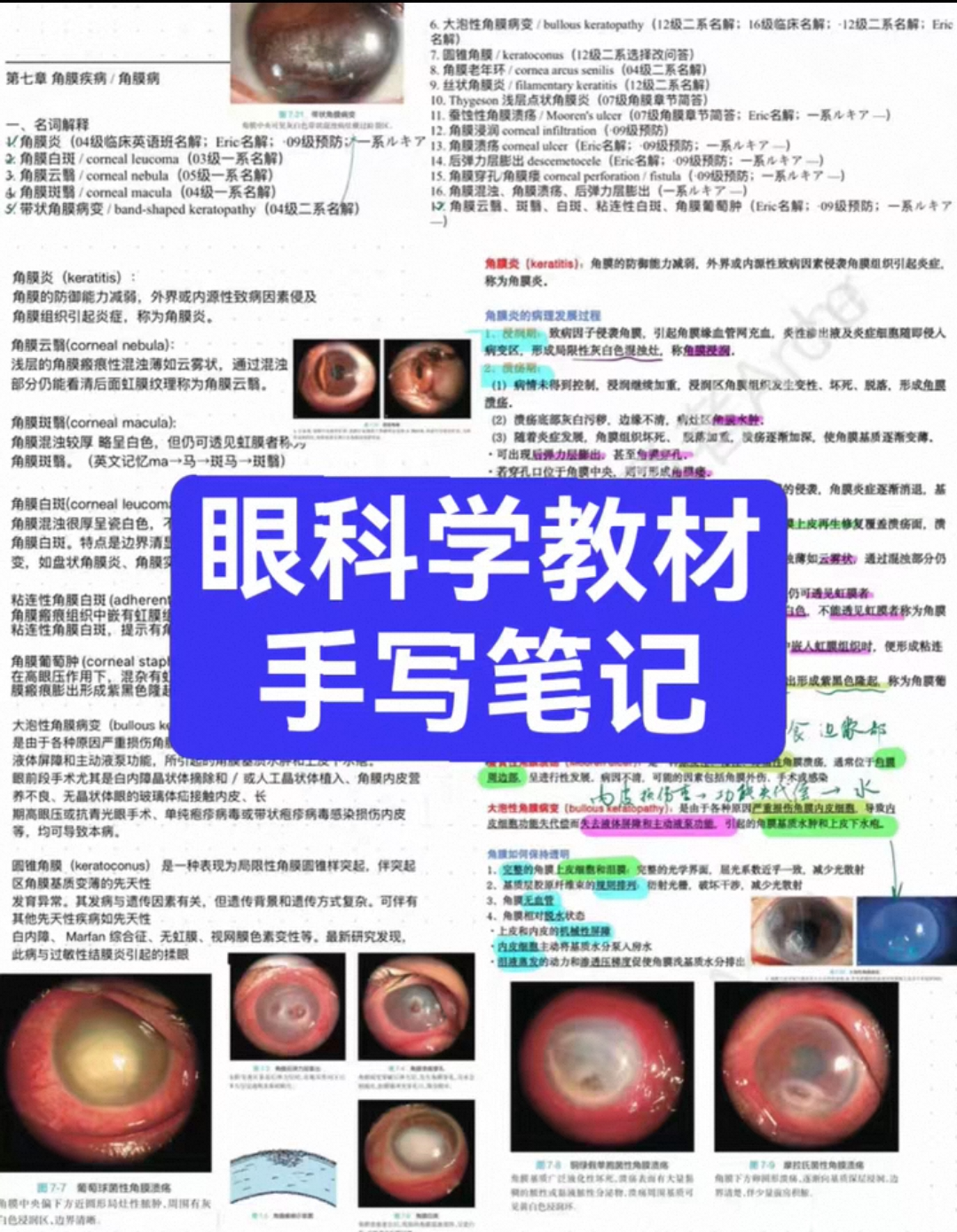 眼科学笔记知识点考点重点图片