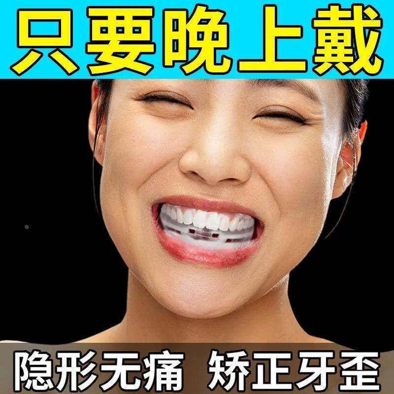 牙齿矫正器成人学生隐形纠正龅牙缝地包天防磨牙整保持器透明牙套