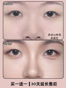 山根美鼻梁增高精华液塌瘦鼻头隆鼻翼神器变高变挺精油缩小贴填充