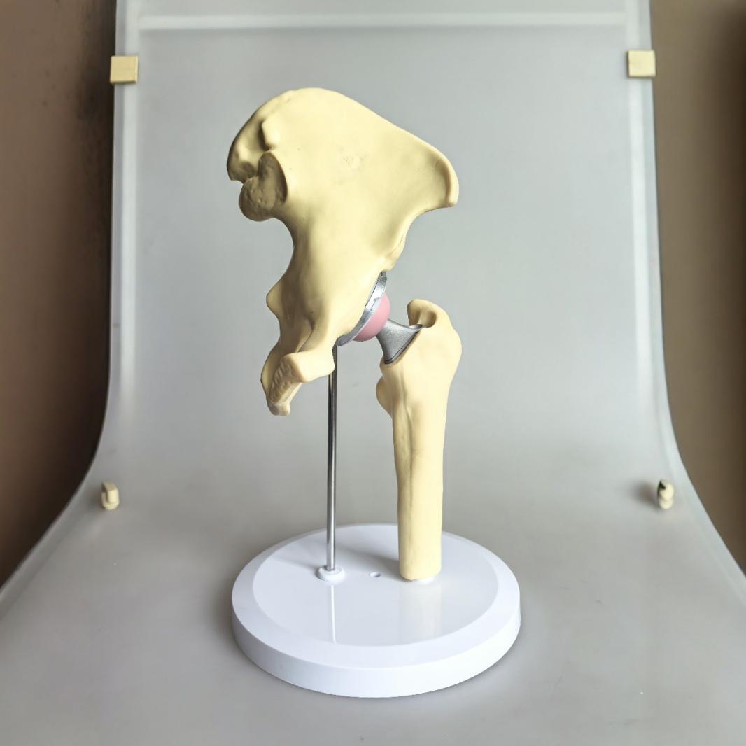 人工髋关节模型髋关节模型髋关节模型（材料PVCABS金属件）