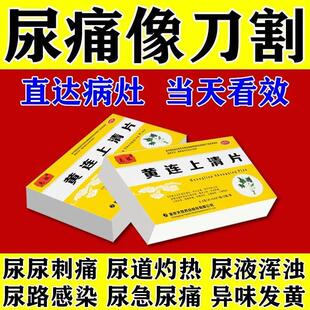治尿路感染尿尿疼小便刺痛药尿疼尿道发炎膀胱炎消炎药尿道口疼痛