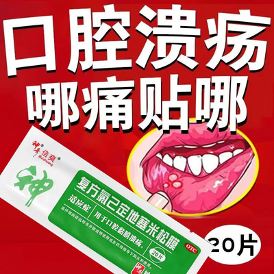 【神奇】复方氯己定地塞米松膜0.05mg0.75mg1mg1.5mg*20片*1袋/盒