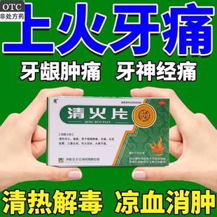 牙痛就用【清热泻火药】清火片通便咽喉肿痛牙痛大便不通老牌子