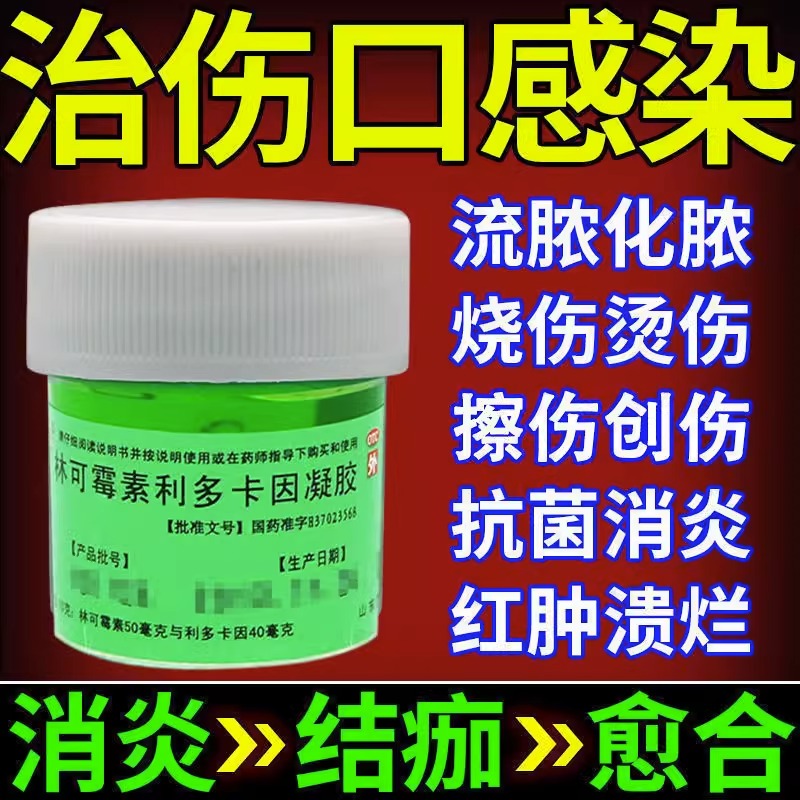 诺舒林可霉素利多卡因凝胶10g绿药膏烧烫伤创伤蚊虫叮咬伤口消炎