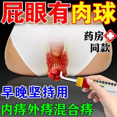 马应龙痔疮膏痔特正品官方旗舰店麝香膏消肉球痔疮有效进口