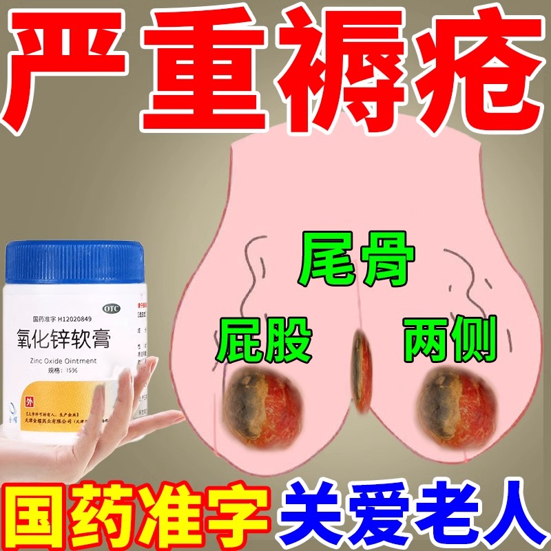 褥疮专用药膏氧化锌软膏老人臀部卧床褥疮压疮外用去腐生肌愈合膏