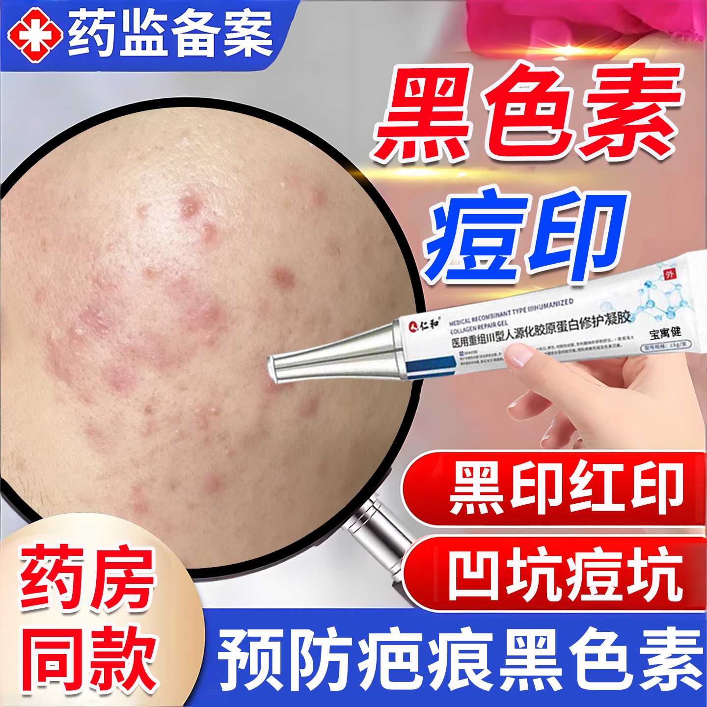 痘印黑色素沉淀去除黑印红印痘坑修复男医用型淡化痤疮疤痕青旗舰