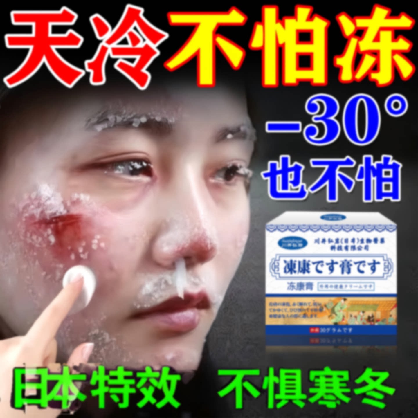 冻疮膏止痒冻伤膏脸部防冻专用消肿冻手脚特效干裂正品官方旗旗舰