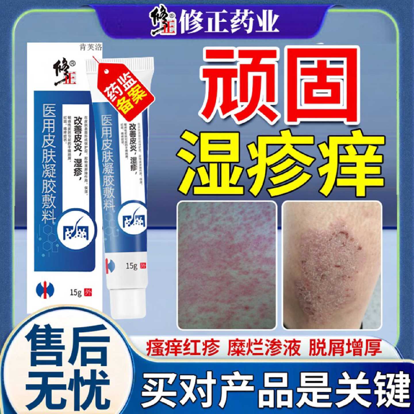 湿毒清软膏湿祛湿z痒根官方旗舰店湿毒止痒去皮肤液专用除湿膏旗