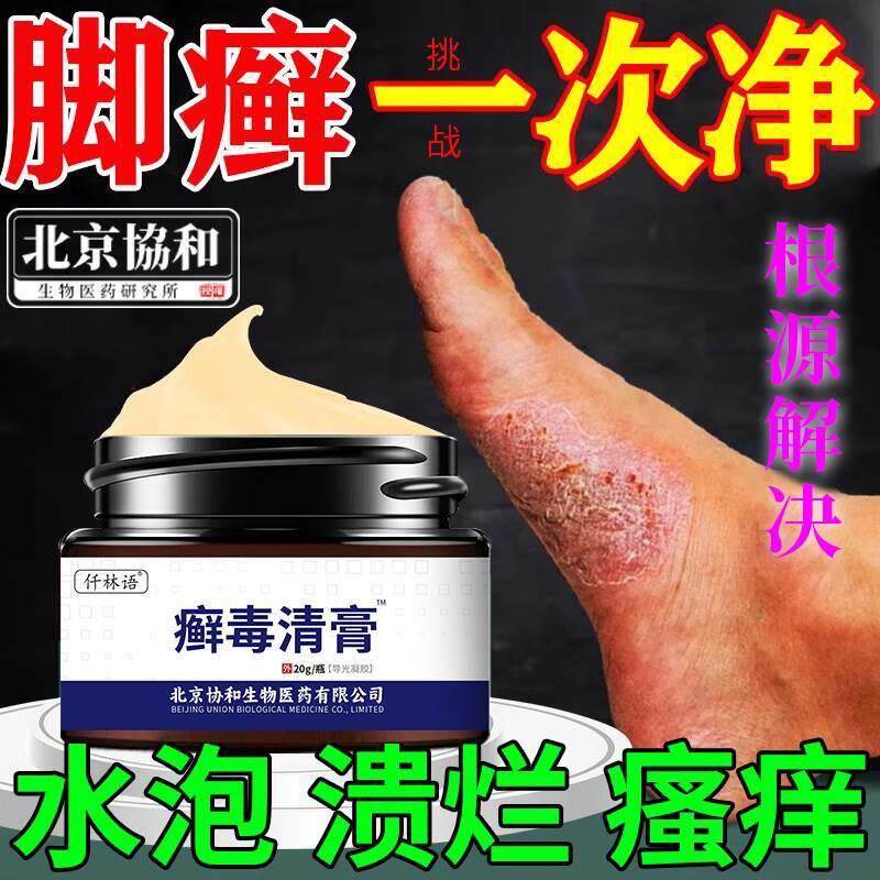 鳞屑角化型脚气湿疹脚癣药膏真菌感染一次净脚气止痒泡脚ca