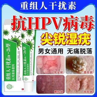 尖锐湿疣hpv病毒药干扰素凝胶去疣药膏根鬼臼毒素软CV