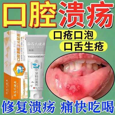 口腔溃疡专用牙膏【天猫正品】