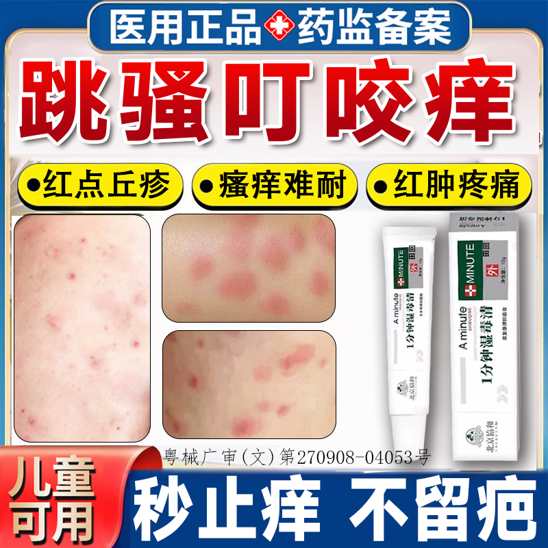 跳蚤咬止痒膏蚊虫叮咬消肿瘙红肿痒用专虱子蚂蚁皮肤过敏隐翅虫gx